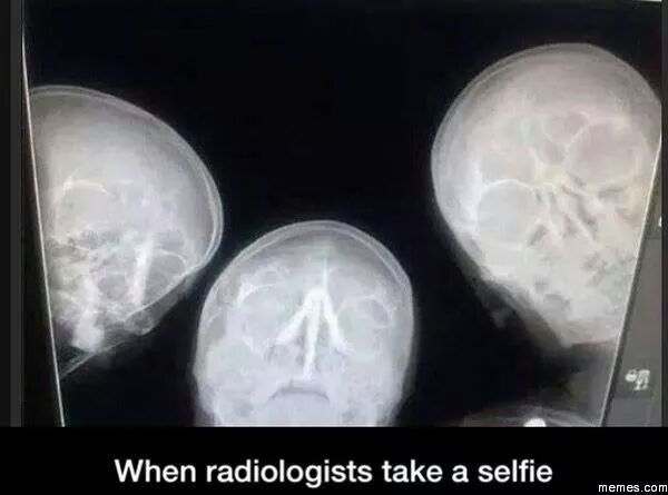 When Radiologist Takes A Selfie Meme Subido Por Streptodernase