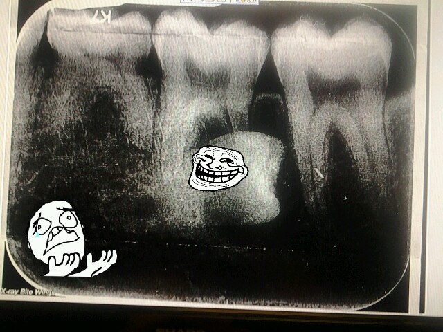 troll tooth. it hurts - meme