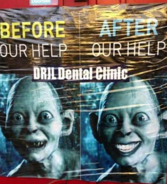 Dental work - meme