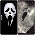 Scream Foetus