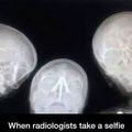 When Radiologist Takes a selfie